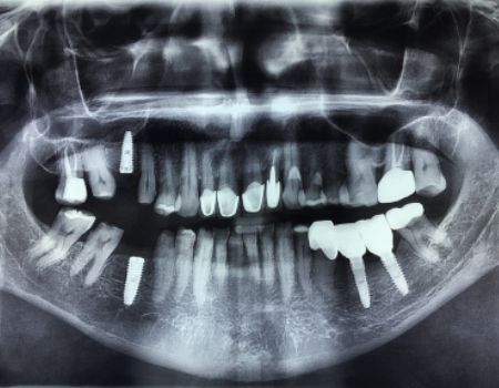 Médico Maxilofacial en Culiacán