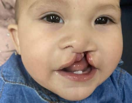 Maxilofacial en Culiacán